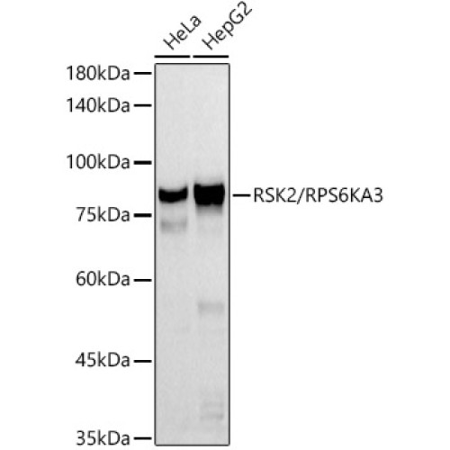 RSK2 / RPS6KA3 Rabbit mAb
