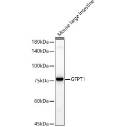 GFPT1 Rabbit mAb