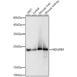 NDUFB9 Rabbit mAb