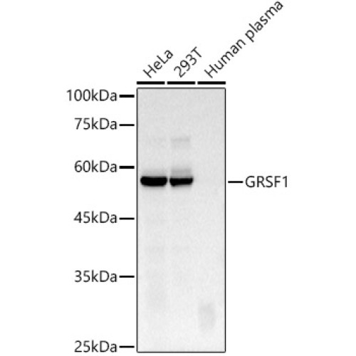 GRSF1 Rabbit mAb