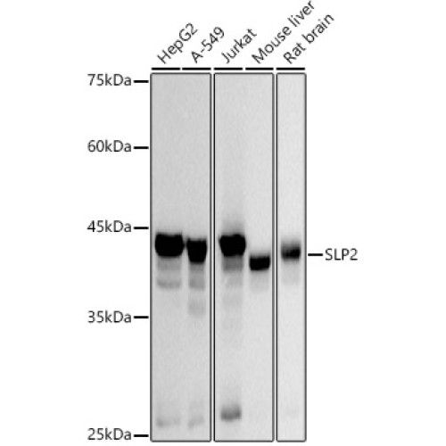 SLP2 Rabbit mAb