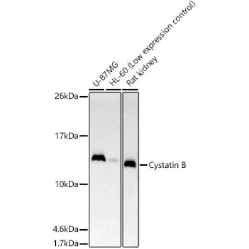 Cystatin B Rabbit mAb