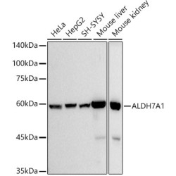 ALDH7A1 Rabbit mAb