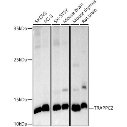 TRAPPC2 Rabbit mAb
