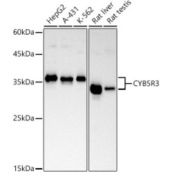 CYB5R3 Rabbit mAb