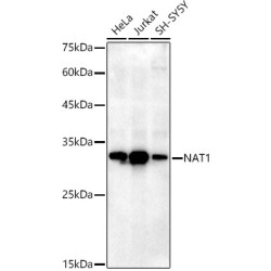 NAT1 Rabbit mAb