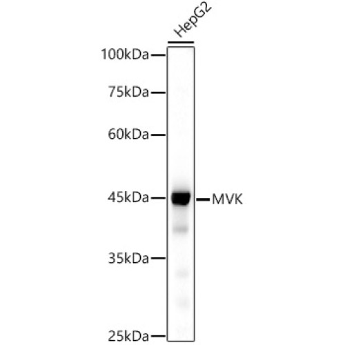 MVK Rabbit mAb