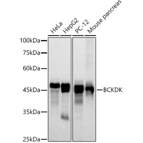 BCKDK Rabbit mAb