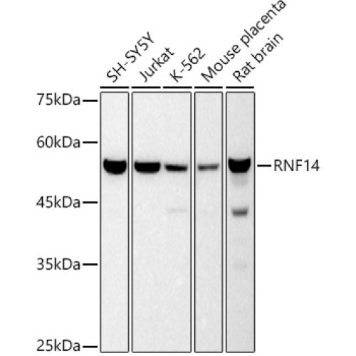 RNF14 Rabbit mAb