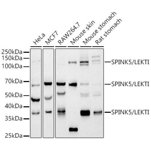 SPINK5 / LEKTI Rabbit mAb