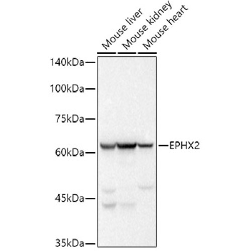 EPHX2 Rabbit mAb