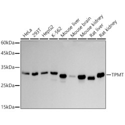 TPMT Rabbit mAb