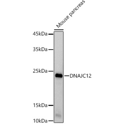 DNAJC12 Rabbit mAb