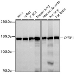 CYFIP1 Rabbit mAb