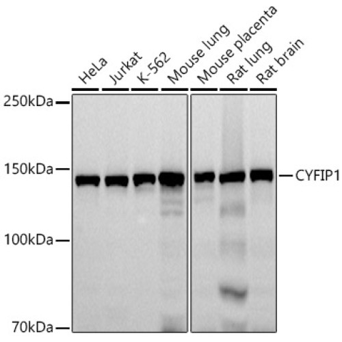CYFIP1 Rabbit mAb