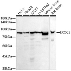 EXOC3 Rabbit mAb