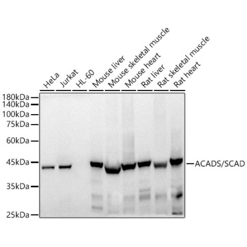ACADS / SCAD Rabbit mAb