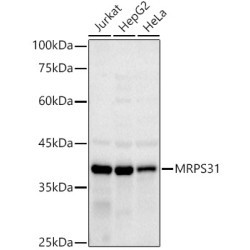 MRPS31 Rabbit mAb