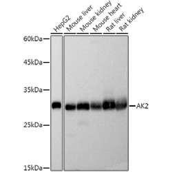 [KO Validated] AK2 Rabbit mAb
