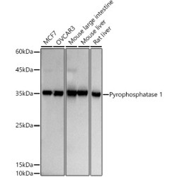 Pyrophosphatase 1 Rabbit mAb