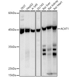ACAT1 Rabbit mAb