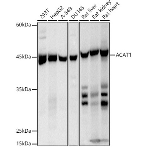 ACAT1 Rabbit mAb