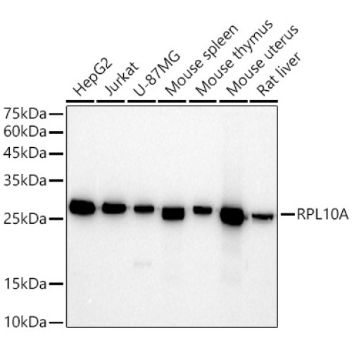 RPL10A Rabbit mAb
