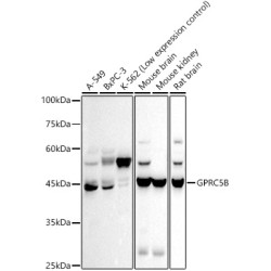 GPRC5B Rabbit mAb