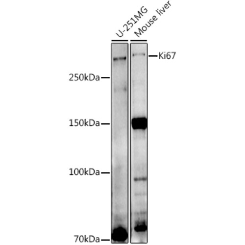 Ki67 Rabbit pAb