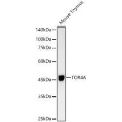 TOR4A Rabbit mAb