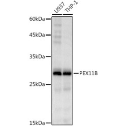 PEX11B Rabbit mAb