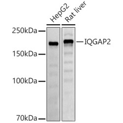 IQGAP2 Rabbit mAb