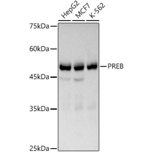 PREB Rabbit mAb