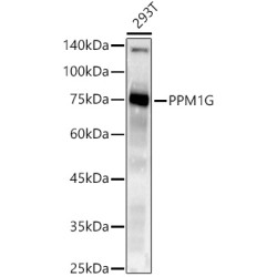 PPM1G Rabbit mAb