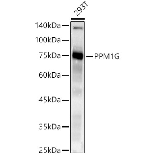PPM1G Rabbit mAb
