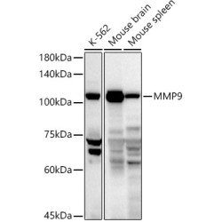 MMP9 Rabbit pAb