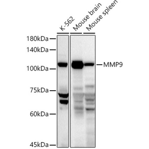 MMP9 Rabbit pAb