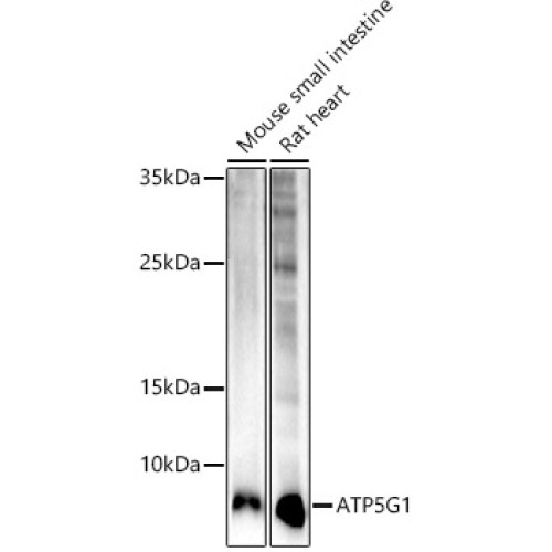 ATP5G1 Rabbit mAb