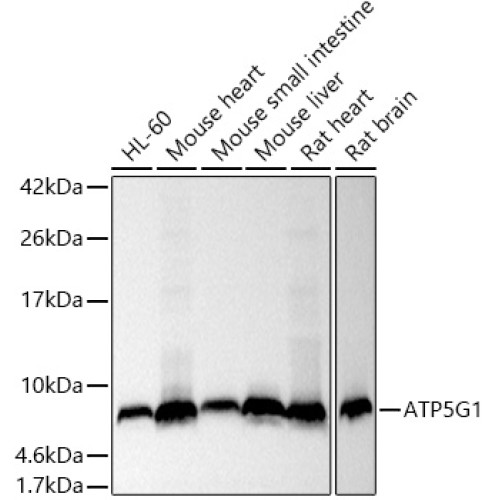ATP5G1 Rabbit mAb