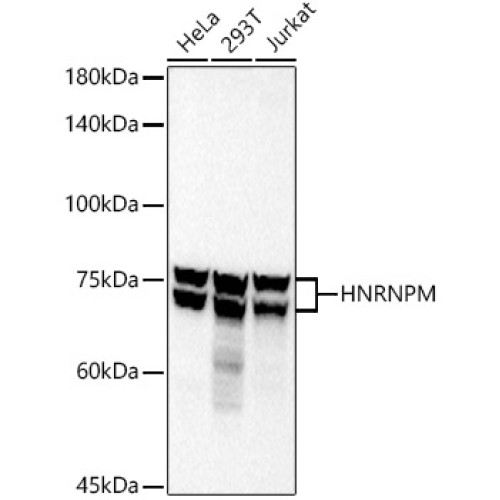 HNRNPM Rabbit mAb