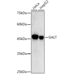 GALT Rabbit mAb