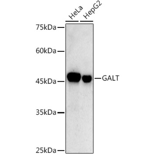 GALT Rabbit mAb