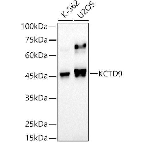 KCTD9 Rabbit mAb