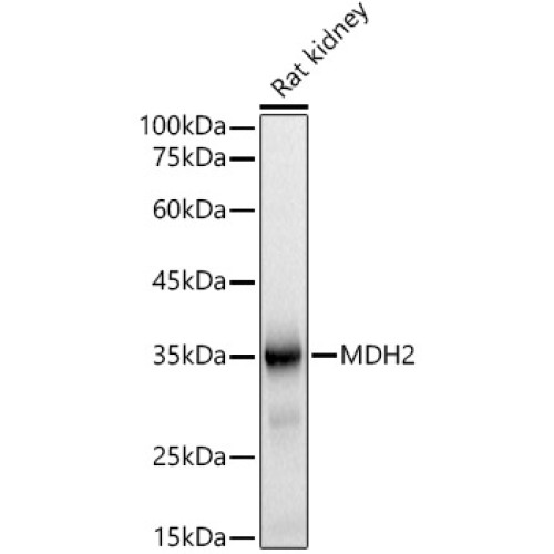 MDH2 Rabbit mAb