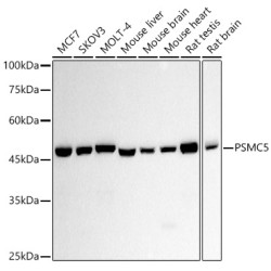 PSMC5 Rabbit mAb