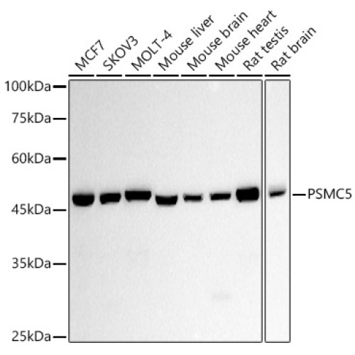 PSMC5 Rabbit mAb