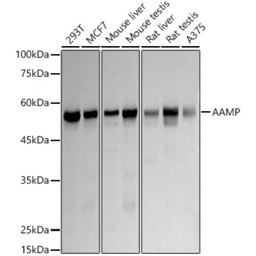 AAMP Rabbit mAb