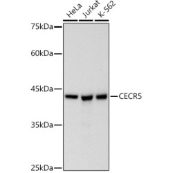 CECR5 Rabbit mAb