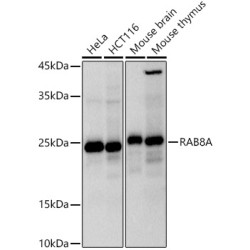 RAB8A Rabbit mAb