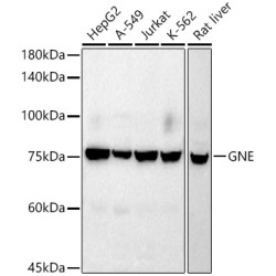 GNE Rabbit mAb